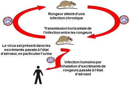 Syndrome_pulmonaire_du_hantavirus